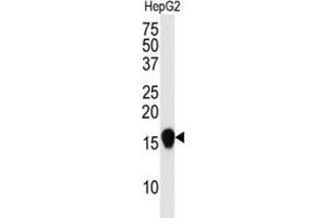 Western Blotting (WB) image for anti-Small Ubiquitin Related Modifier 4 (SUMO4) (Met55Val-Mutant) antibody (ABIN2996873)