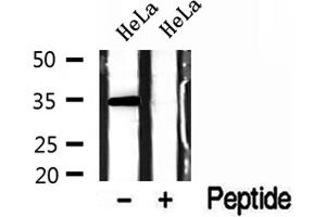 Western blot analysis of extracts of HeLa cells, using GOLPH3 antibody. (GOLPH3 Antikörper  (C-Term))
