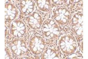 Immunohistochemistry of TEM2 in human colon tissue with this product at 2. (RASD2 Antikörper  (N-Term))
