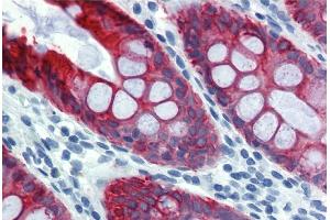 Immunohistochemistry staining of human colon (paraffin sections) using anti-cytokeratin 18 (clone DA-7). (Cytokeratin 18 Antikörper)