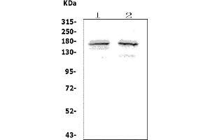 Western blot analysis of ASXL1 using anti-ASXL1 antibody (ABIN7600008).