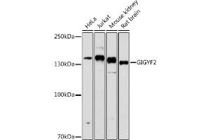 Western blot analysis of extracts of various cell lines, using GIGYF2 antibody (ABIN6132175, ABIN6141083, ABIN6141084 and ABIN6215640) at 1:1000 dilution. (GIGYF2 Antikörper  (AA 350-500))