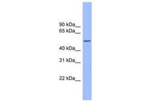 Image no. 1 for anti-Colony Stimulating Factor 1 (Macrophage) (CSF1) (AA 215-264) antibody (ABIN6743293) (M-CSF/CSF1 Antikörper  (AA 215-264))