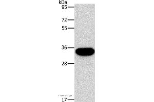 Western blot analysis of PC3 cell, using HOXB13 Polyclonal Antibody at dilution of 1:900 (HOXB13 Antikörper)