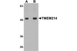 Western blot analysis of TMEM214 in rat brain tissue lysate with this product at (A) 1 and (B) 2 μg/ml. (TMEM214 Antikörper  (Center))