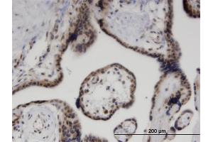 Immunoperoxidase of monoclonal antibody to ZNF232 on formalin-fixed paraffin-embedded human placenta. (ZNF232 Antikörper  (AA 181-280))