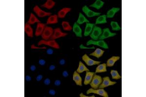 eEF2K Mouse Monoclonal Antibody staining HepG2 cells by IF/ICC. (EEF2K Antikörper  (Internal Region))