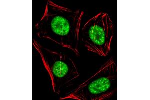 Immunofluorescent analysis of 4 % paraformaldehyde-fixed, 0. (RBBP5 Antikörper  (C-Term))