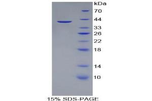 SDS-PAGE analysis of Pig Apolipoprotein A2 Protein. (APOA2 Protein)