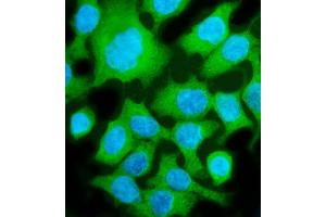 IF analysis of ALDOB using anti-ALDOB antibody (ABIN7602563).