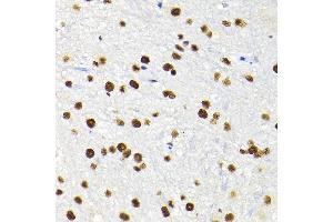 Immunohistochemistry of paraffin-embedded mouse spinal cord using K/K/TRIM28 Rabbit pAb  at dilution of 1:200 (40x lens).