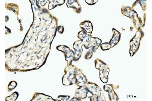 IHC analysis of BCKDK using anti-BCKDK antibody (ABIN7601470). (BCKDK Antikörper  (AA 36-316))