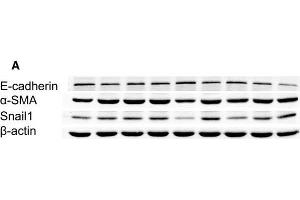 Downregulation of Snail1 reduced high glucose-induced EMT and TGF-β1 secretion in cultured HK2 cells. (SNAIL Antikörper  (C-Term))