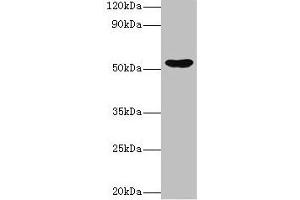 Western blot All lanes: EPHX1 antibody at 2 μg/mL + Hela whole cell lysate Secondary Goat polyclonal to rabbit IgG at 1/10000 dilution Predicted band size: 53 kDa Observed band size: 53 kDa (EPHX1 Antikörper  (AA 1-455))