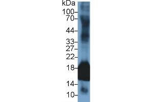Detection of SOD1 in Rabbit Uterus lysate using Polyclonal Antibody to Superoxide Dismutase 1 (SOD1) (SOD1 Antikörper  (AA 2-153))