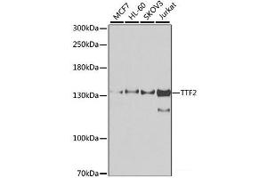 Western blot analysis of extracts of various cell lines using TTF2 Polyclonal Antibody at dilution of 1:1000. (TTF2 Antikörper)