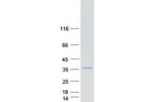 Western Blotting (WB) image for Glucosamine-6-Phosphate Deaminase 2 (GNPDA2) protein (Myc-DYKDDDDK Tag) (ABIN2721959)