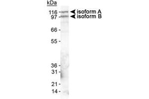 Western blot analysis of EPB41L3 in mouse brain lysate using EPB41L3 polyclonal antibody .