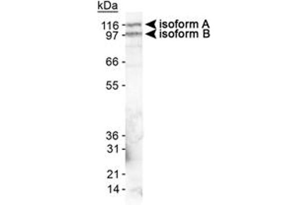 EPB41L3 Antikörper  (AA 400-500)