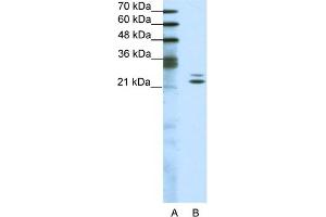 WB Suggested Anti-BUD31 Antibody Titration:  1. (BUD31 Antikörper  (Middle Region))