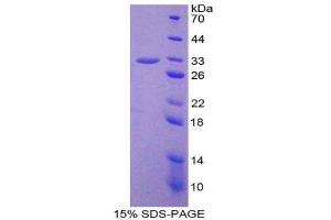 SDS-PAGE (SDS) image for Nucleoporin 37kDa (NUP37) (AA 34-279) protein (His tag) (ABIN1879188)