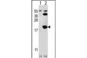 Western blot analysis of UBE2I (arrow) using rabbit polyclonal UBE2I Antibody (S7) (ABIN387910 and ABIN2844306).