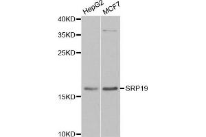 Western blot analysis of extracts of various cell lines, using SRP19 antibody. (SRP19 Antikörper)