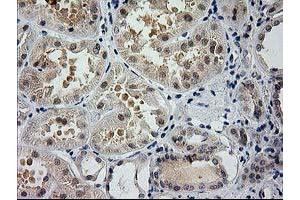Immunohistochemical staining of paraffin-embedded Human Kidney tissue using anti-GSS mouse monoclonal antibody.