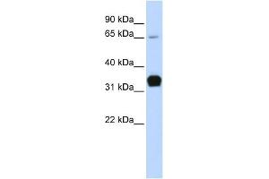 Troponin T Type 1 antibody used at 1 ug/ml to detect target protein. (TNNT1 Antikörper)