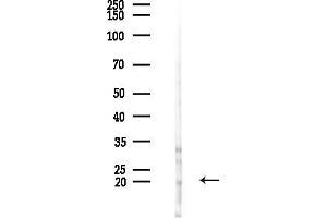 Western blot analysis of lysates from HUVEC cells(starvation,24h treatment), using MRPS25 Antibody at 1/1000 dilution.