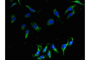 Immunofluorescent analysis of Hela cells using ABIN7147809 at dilution of 1:100 and Alexa Fluor 488-congugated AffiniPure Goat Anti-Rabbit IgG(H+L) (CMTM2 Antikörper  (AA 1-80))