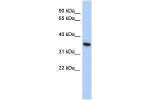 WB Suggested Anti-MXI1 Antibody Titration: 0. (MXI1 Antikörper  (Middle Region))