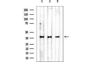 anti-NIF3 NGG1 Interacting Factor 3-Like 1 (NIF3L1) antibody