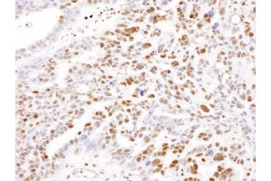 Immunohistochemistry (IHC) image for anti-SAM Domain and HD Domain 1 (SAMHD1) (AA 450-500) antibody (ABIN7454948)