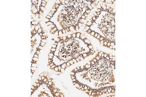 Immunohistochemical analysis of paraffin-embedded human small intestine tissue using (ABIN656961 and ABIN2846145) performed on the Leica® BOND RXm.