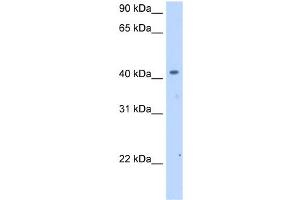 WB Suggested Anti-SLC25A24 Antibody Titration:  2. (SLC25A24 Antikörper  (Middle Region))