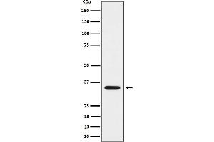 Western Blotting (WB) image for anti-Myelin Basic Protein (MBP) antibody (ABIN7607106)