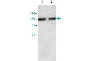 Western blot analysis of HUVEC cell (Lane 1) and human placenta (Lane 2) lysate with RBBP6 polyclonal antibody  at 1 : 1000 dilution. (RBBP6 Antikörper  (Internal Region))