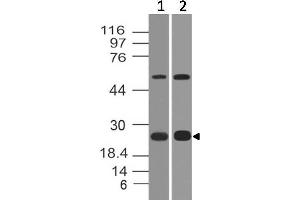 Image no. 1 for anti-V-Set Domain Containing T Cell Activation Inhibitor 1 (VTCN1) (AA 50-270) antibody (ABIN5027049)