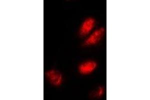 Immunofluorescent analysis of ASF1A staining in A549 cells. (ASF1A Antikörper)