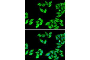 Immunofluorescence analysis of MCF7 cell using RPS14 antibody. (RPS14 Antikörper)