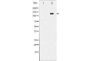 Western blot analysis of Abl phosphorylation expression in Adriamycin treated COS7 whole cell lysates,The lane on the left is treated with the antigen-specific peptide.