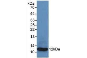 Detection of Recombinant S100A8, Human using Monoclonal Antibody to S100 Calcium Binding Protein A8 (S100A8) (S100A8 Antikörper  (AA 1-93))