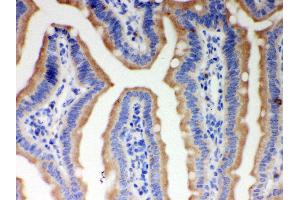 Immunohistochemistry (IHC) image for anti-Inositol 1,4,5-Trisphosphate Receptor, Type 3 (ITPR3) (AA 70-95), (N-Term) antibody (ABIN3043863)