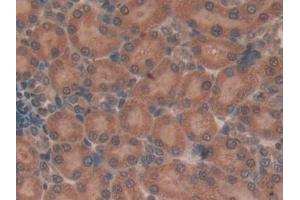 Detection of TUBd in Rat Kidney Tissue using Polyclonal Antibody to Tubulin Delta (TUBd) (TUBD1 Antikörper  (AA 238-482))