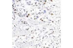 Immunohistochemistry (IHC) image for anti-Baculoviral IAP Repeat-Containing 5 (BIRC5) (AA 1-142) antibody (ABIN6137562)