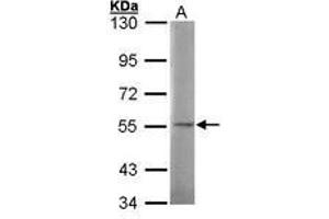 Image no. 1 for anti-N-Sulfoglucosamine Sulfohydrolase (SGSH) (AA 44-200) antibody (ABIN467364) (SGSH Antikörper  (AA 44-200))
