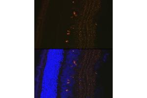 Immunofluorescence (IF) image for anti-Cellular Retinoic Acid Binding Protein 1 (CRABP1) antibody (ABIN7266269)
