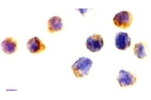 Immunohistochemistry (IHC) image for anti-Apoptosis-Inducing Factor, Mitochondrion-Associated, 1 (AIFM1) (N-Term) antibody (ABIN1031220) (AIF Antikörper  (N-Term))