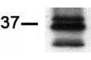Western blot of PIM2 antibody (mAb).